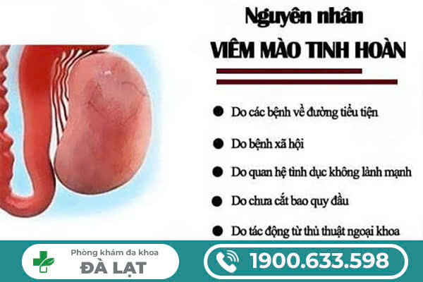 Hình ảnh minh họa